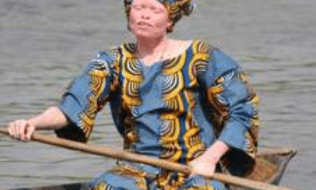 La double galère des femmes albinos  