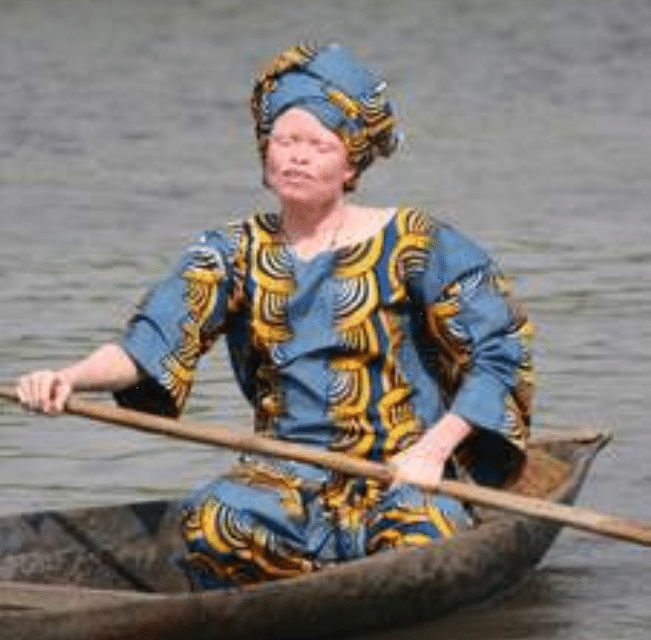 La double galère des femmes albinos  